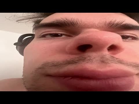 Мурзофикс Мем лицо