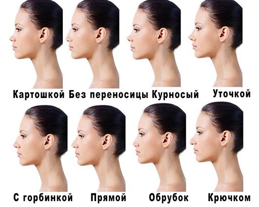 Типы Носов курносый