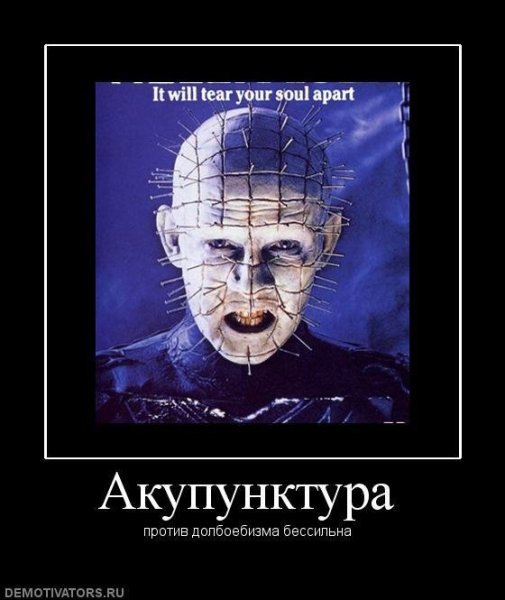 Иглотерапия юмор