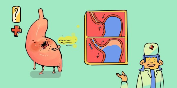 Рисунок смешной изжога