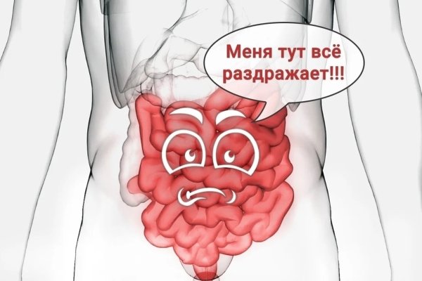 Синдром раздраженного кишечника (СРК)