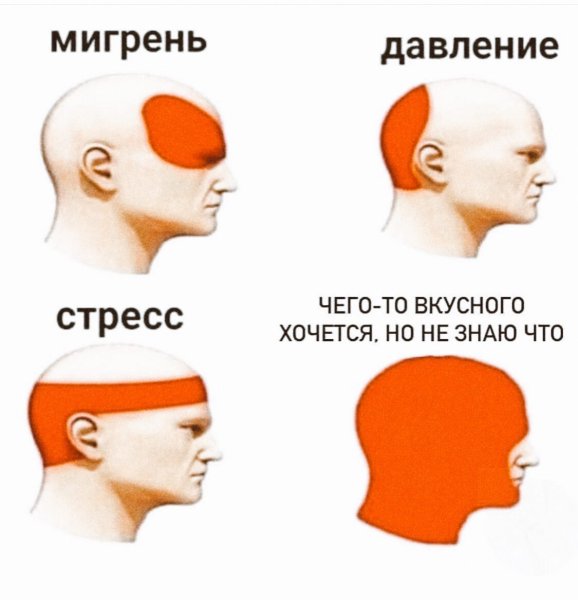 Виды головной боли