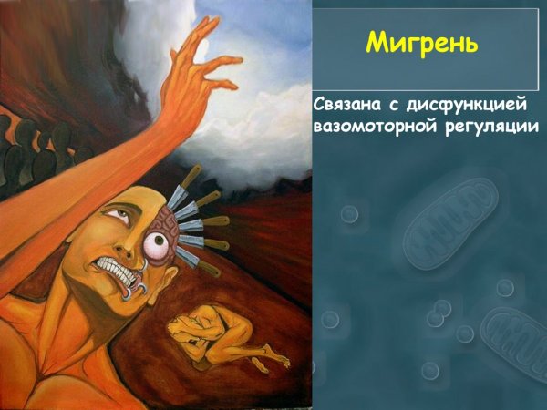 Мигрень картина