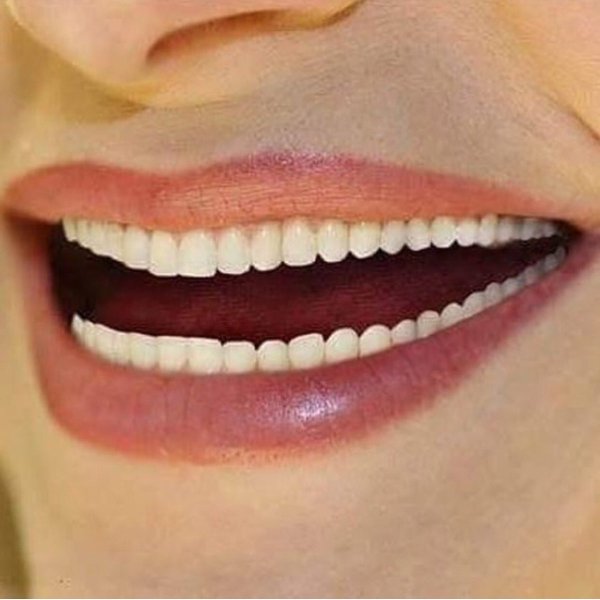 Улыбка в 33 зуба